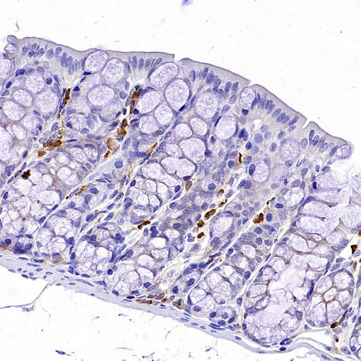 CD25/IL-2Rα Recombinant Rabbit mAb (SDT-2234-65)