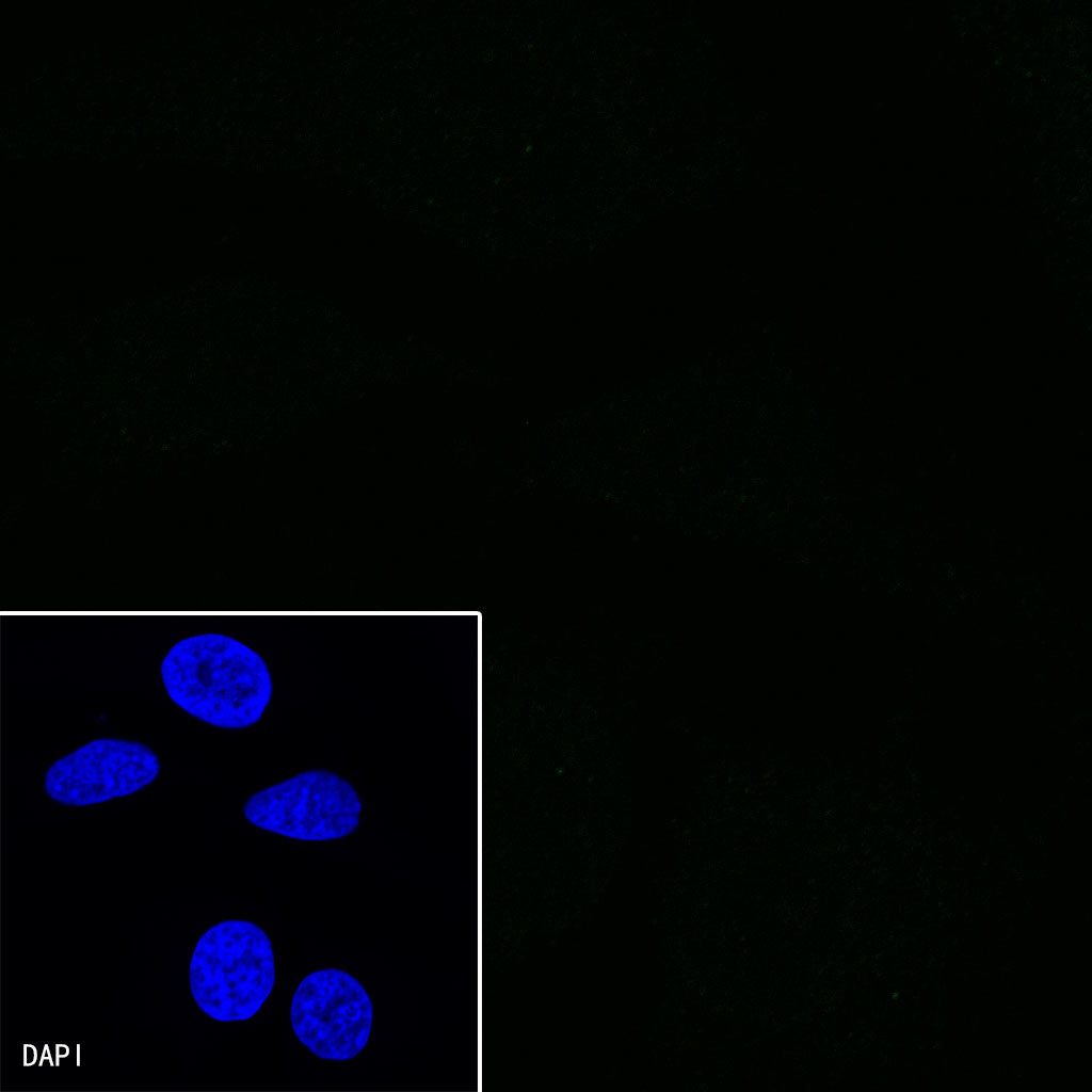 S-RMab®SALL4 Recombinant Rabbit mAb (SDT-R232)