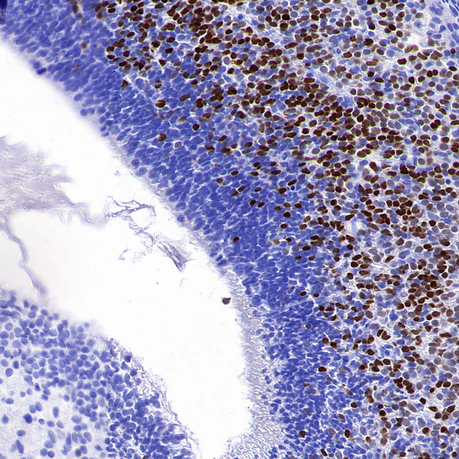 Lhx2/LH2 Recombinant Rabbit mAb (S-3867-28)