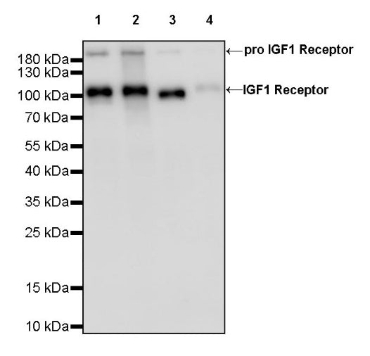 IGF1 Receptor Recombinant Rabbit mAb (S-1617-146)
