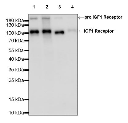 IGF1 Receptor Recombinant Rabbit mAb (S-1617-146)