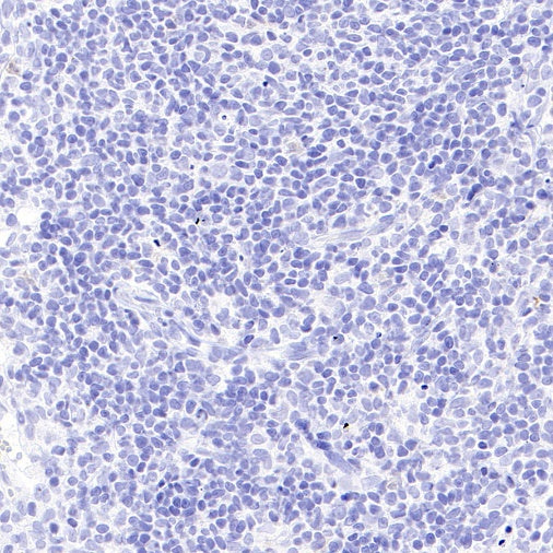 Mouse mAb IgA, κ Isotype Control (S-844-79-1)