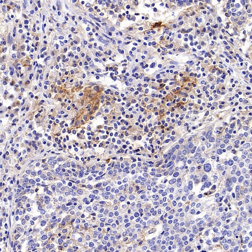 Lymphocyte antigen 75/CD205 Recombinant Rabbit mAb (S-2707-25)