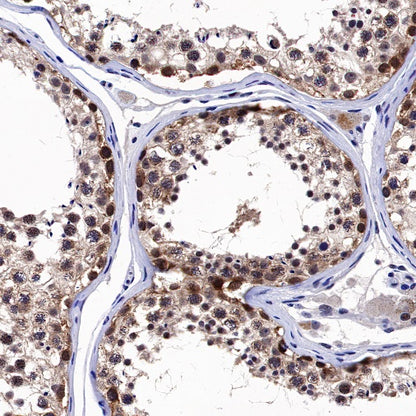 Keap1 Recombinant Rabbit mAb (S-1520-8)