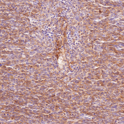 CD146 Recombinant Rabbit mAb (SDT-348-6)