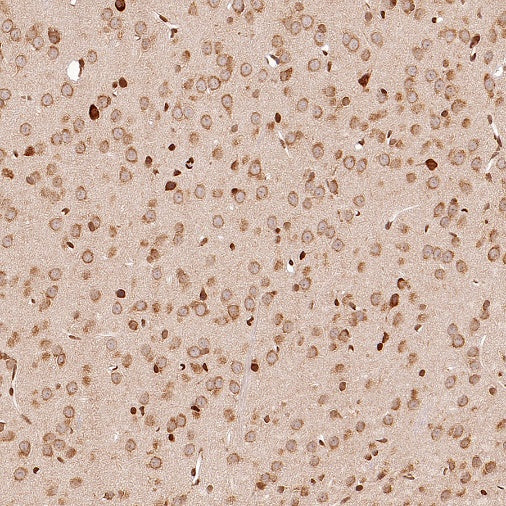 eIF4E Rabbit Polyclonal Antibody