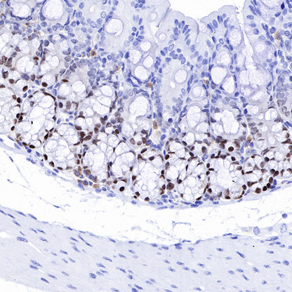SOX9 Recombinant Rabbit mAb (SDT-019-29)