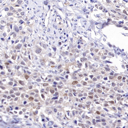 MYG1 Recombinant Rabbit mAb (S-2248-25)