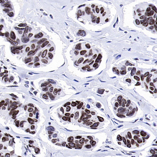 Histone H3 (di methyl K9) Recombinant Rabbit mAb (S-903-52)