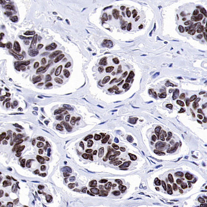Histone H3 (di methyl K9) Recombinant Rabbit mAb (S-903-52)