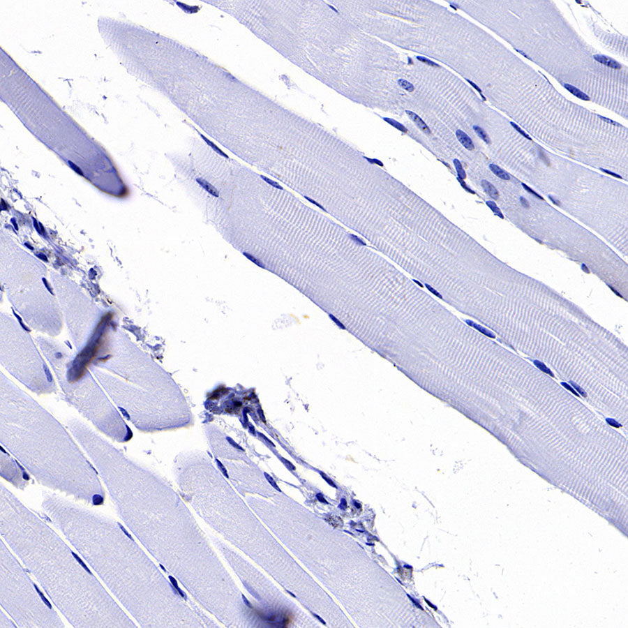 SCTR Recombinant Rabbit mAb (S-3949-52)