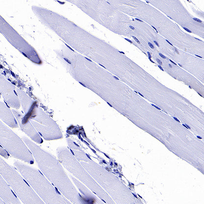 SCTR Recombinant Rabbit mAb (S-3949-52)