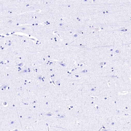 TACSTD2/TROP2 Recombinant Rabbit mAb (S-R238)