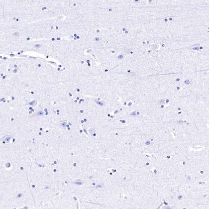 TACSTD2/TROP2 Recombinant Rabbit mAb (S-R238)