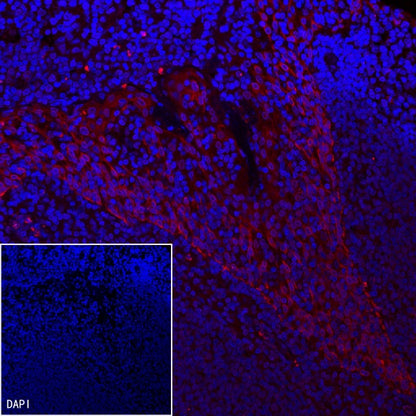 PD-L1 Recombinant Rabbit mAb (Alexa Fluor® 555 Conjugate) (SDT-119-16)