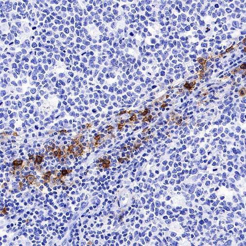DPEP1 Recombinant Rabbit mAb (S-R293)
