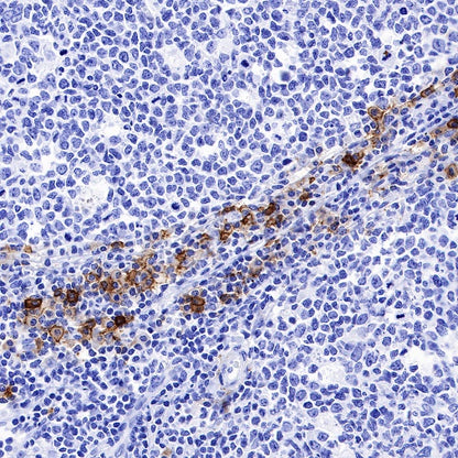 DPEP1 Recombinant Rabbit mAb (S-R293)