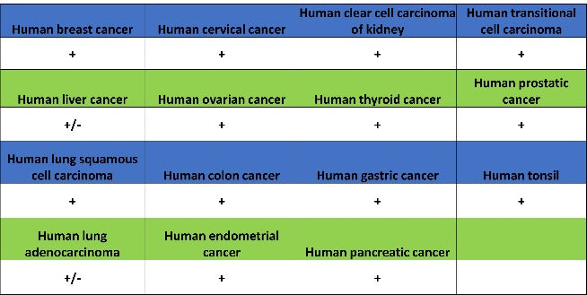 Ezrin Recombinant Rabbit mAb (S-1894-4)