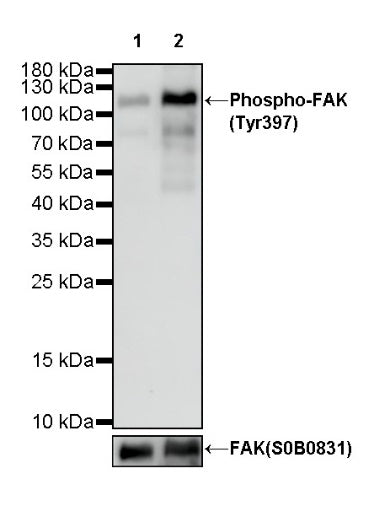 Phospho-FAK (Tyr397) Rabbit Polyclonal Antibody
