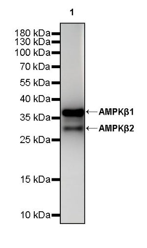 AMPKβ1/2 Recombinant Rabbit mAb (S-2728-26)