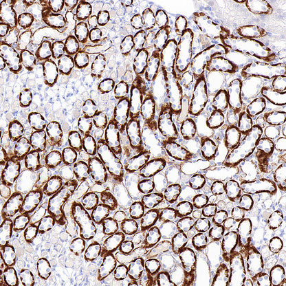 ROBO2 Recombinant Rabbit mAb (S-4563-43)