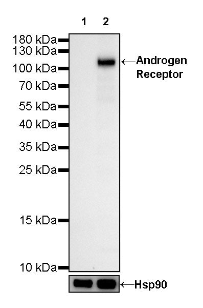 Androgen Receptor Recombinant Rabbit mAb (SDT-R167)