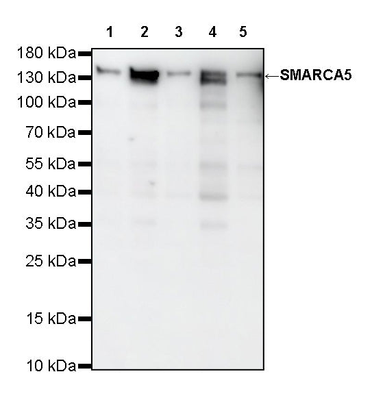 SMARCA5 Recombinant Rabbit mAb (S-4446-48)