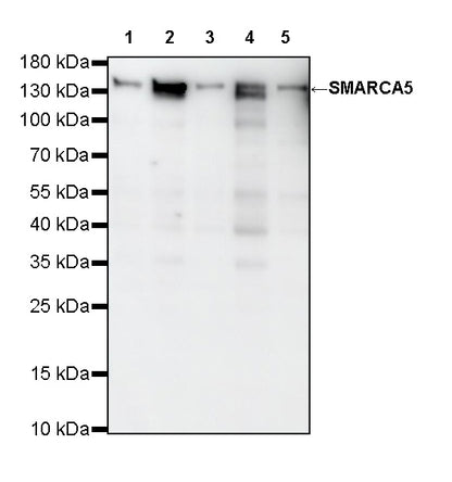 SMARCA5 Recombinant Rabbit mAb (S-4446-48)