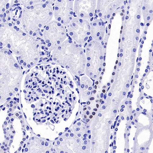 GATA3 Recombinant Mouse mAb (SDT-3180)