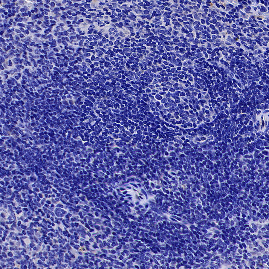 VGLUT2 Recombinant Rabbit mAb (S-4399-14)