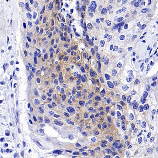 TRPV4 Recombinant Rabbit mAb (S-1746-65)