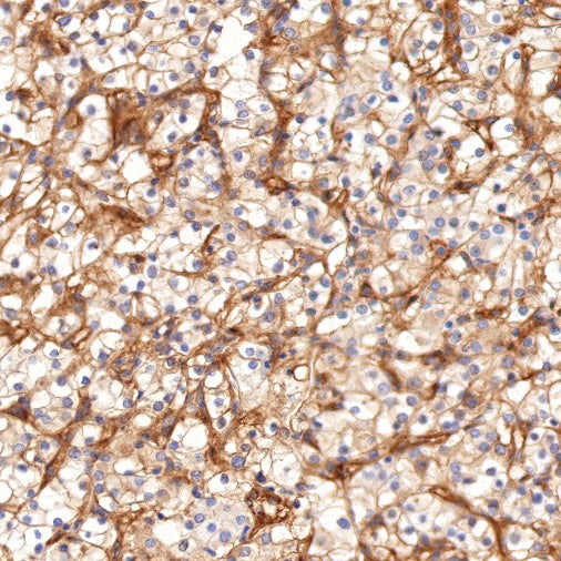 Integrin alpha V Recombinant Rabbit mAb (S-1798-27)