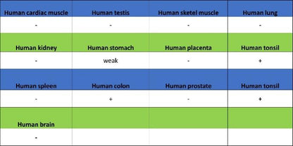 AiolosI/KZF3 Recombinant Rabbit mAb (S-1268-42)