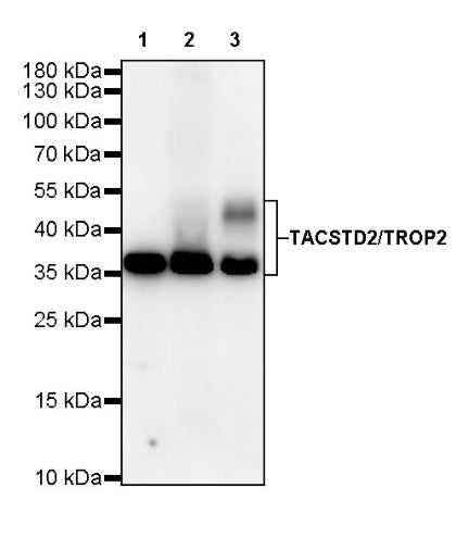 TACSTD2/TROP2 Recombinant Rabbit mAb (S-R237)