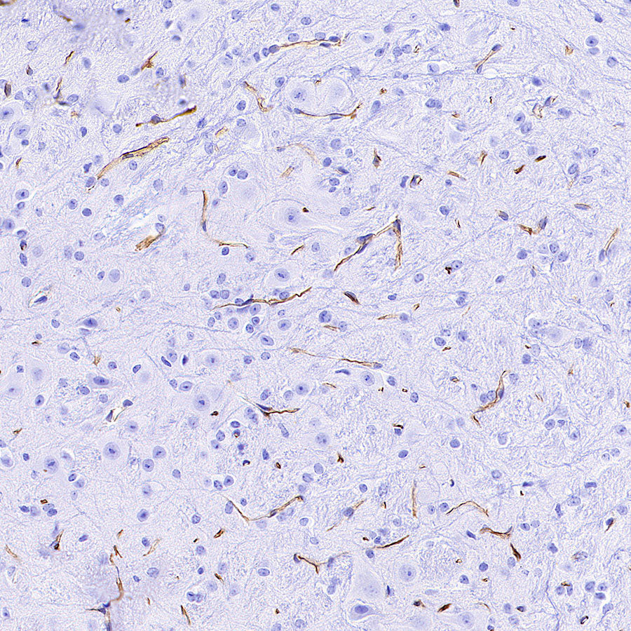 Nestin Recombinant Rabbit mAb (S-3890-112)