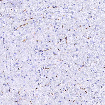 Nestin Recombinant Rabbit mAb (S-3890-112)