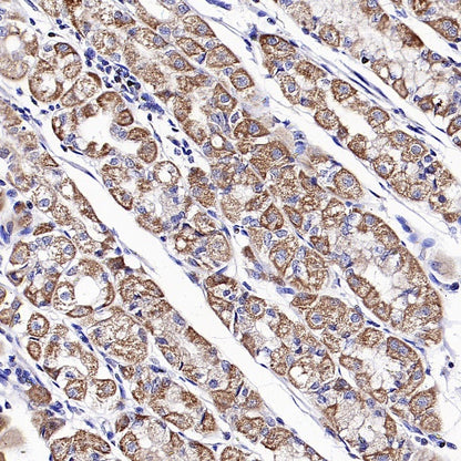 OPA1 Recombinant Rabbit mAb (S-2189-65)
