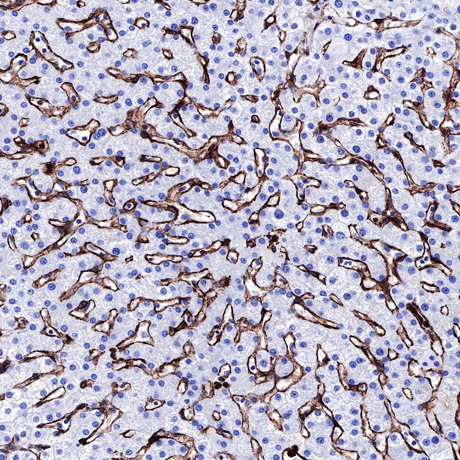 Caveolin-1 Recombinant Rabbit mAb (SDT-065-20)