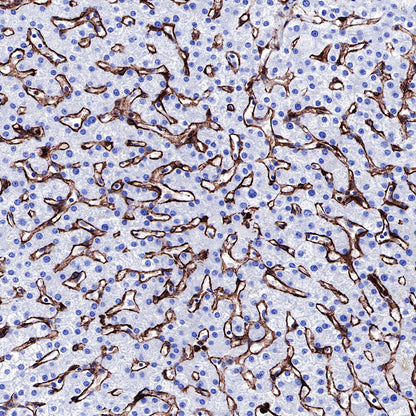 Caveolin-1 Recombinant Rabbit mAb (SDT-065-20)