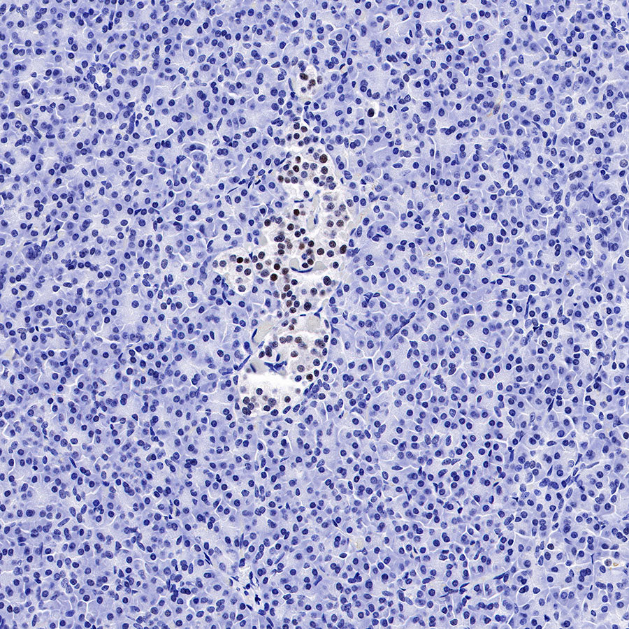 Cyclin D3 Recombinant Rabbit mAb (SDT-R124)
