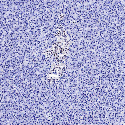Cyclin D3 Recombinant Rabbit mAb (SDT-R124)