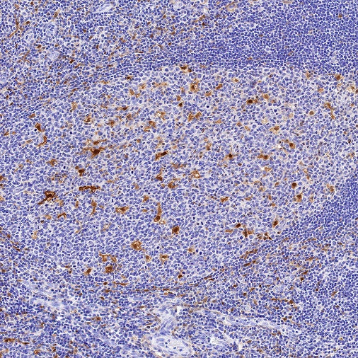 QPRT Recombinant Rabbit mAb (S-1228-31)