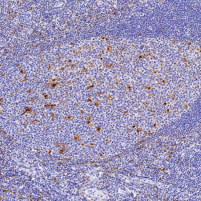 QPRT Recombinant Rabbit mAb (S-1228-31)