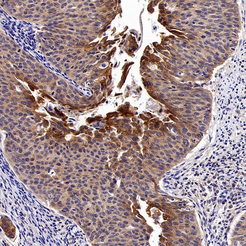 NF-κB2 p100/p52 Recombinant Rabbit mAb (S-2502-70)