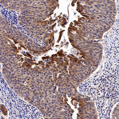 NF-κB2 p100/p52 Recombinant Rabbit mAb (S-2502-70)