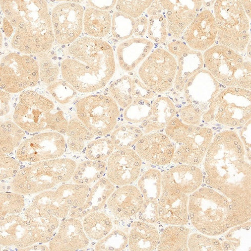 SOCS2 Recombinant Rabbit mAb (S-4956-21)