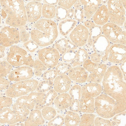 SOCS2 Recombinant Rabbit mAb (S-4956-21)