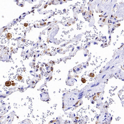 STING Recombinant Rabbit mAb (S-1392-33)