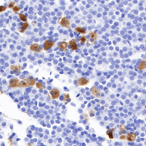 S-RMab® FSHB Recombinant Rabbit mAb (SDT-544-22)