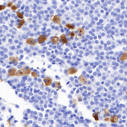 S-RMab® FSHB Recombinant Rabbit mAb (SDT-544-22)